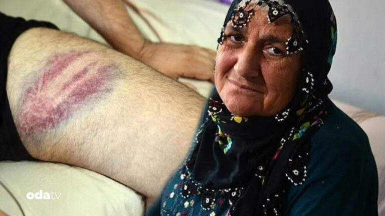 yil oldu kackadina miras yok deyip oglunu dovduler 95ALgE6u