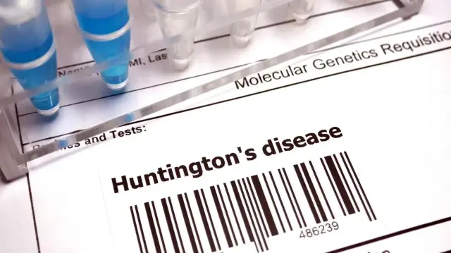 huntington hastaliginda tarihi gelisme yeni tedavi yuzde 75 yavaslatiyor UEztawlC